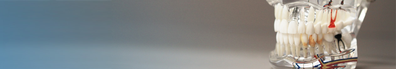 Wurzelkanalbehandlung